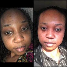 Load image into Gallery viewer, Brightening Black Soap(New Formula!)