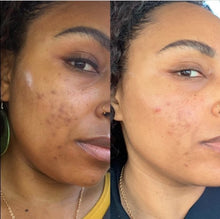 Load image into Gallery viewer, Lemon Dream Face Cream(New Formula!)
