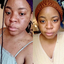 Load image into Gallery viewer, Brightening Black Soap(New Formula!)