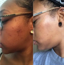 Load image into Gallery viewer, Brightening Black Soap(New Formula!)