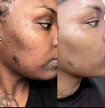 Load image into Gallery viewer, Brightening Black Soap(New Formula!)