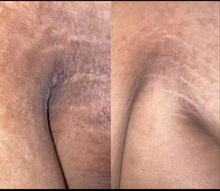 Load image into Gallery viewer, Brightening Black Soap(New Formula!)