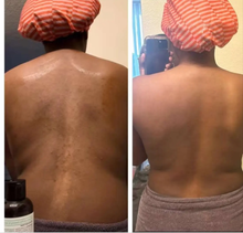 Load image into Gallery viewer, Brightening Black Soap(New Formula!)