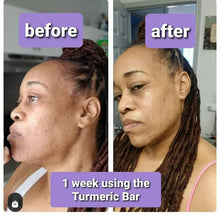 Load image into Gallery viewer, Turmeric Glow Soap (New formula!)