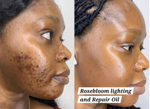 Load image into Gallery viewer, Rose Bloom Lighting & Repair Oil (New Formula!)