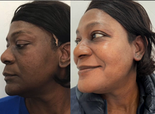 Load image into Gallery viewer, Gluta berry Whitening face & Body Oil
