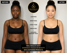 Load image into Gallery viewer, Double Glutathione Injection Plus Bleaching Lotion available August 13th