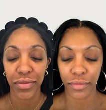 Load image into Gallery viewer, Kojic Acid Vitamin C Shower Gel