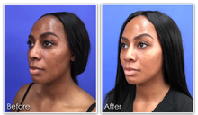 Load image into Gallery viewer, Gluta berry Whitening face & Body Oil
