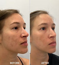Load image into Gallery viewer, Kojic Acid Vitamin C Shower Gel