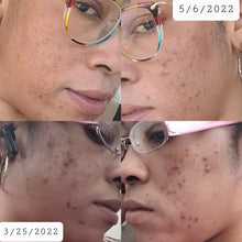 Load image into Gallery viewer, Lemon Dream Face Cream(New Formula!)