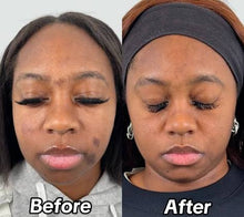 Load image into Gallery viewer, Honey ,Kojic Acid and Turmeric Luxury Whitening Soap For face and body
