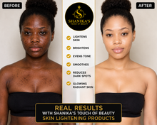 Load image into Gallery viewer, Double Glutathione Injection Plus Bleaching Lotion available August 13th
