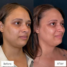 Load image into Gallery viewer, Honey ,Kojic Acid and Turmeric Luxury Whitening Soap For face and body
