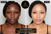 Load image into Gallery viewer, Double Glutathione Injection Plus Bleaching Lotion available August 13th
