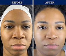 Cargar imagen en el visor de la galería, Bloom Gluta Berry Face and Body Cream
