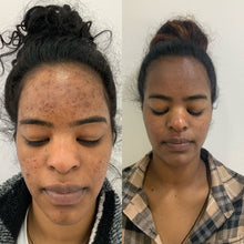 Load image into Gallery viewer, Honey ,Kojic Acid and Turmeric Luxury Whitening Soap For face and body
