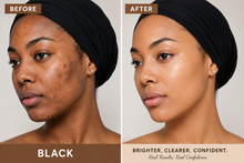 Load image into Gallery viewer, Caro White Lightening Beauty Cream "Available by August 28th"
