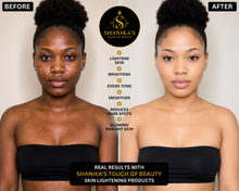 Load image into Gallery viewer, Double Glutathione Injection Plus Bleaching Lotion available August 13th
