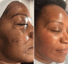 Cargar imagen en el visor de la galería, Bloom Gluta Berry Face and Body Cream
