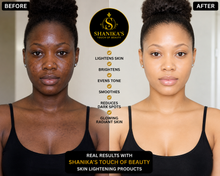 Load image into Gallery viewer, Double Glutathione Injection Plus Bleaching Lotion available August 13th
